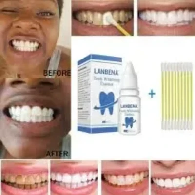 Lanbena teeth whitening essence
